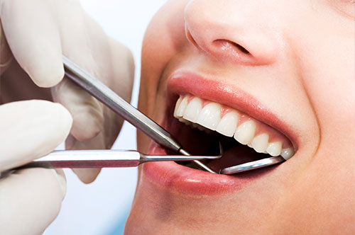 Spring Cleaning Your Smile: The Importance of Regular Dental Cleanings